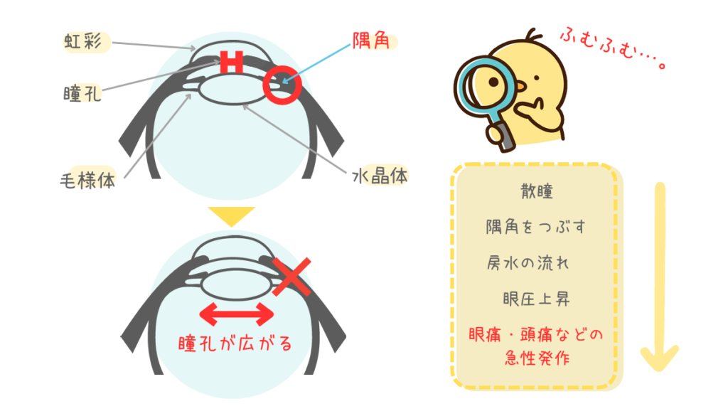 抗コリン薬緑内障